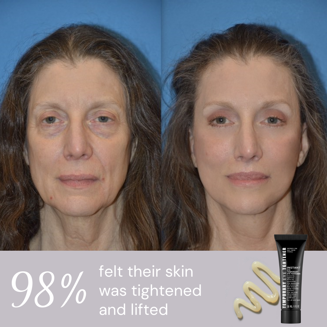 ⏰Last Day Sale 50% OFF🔥Instant Wrinkle Eye Tightener cream✅