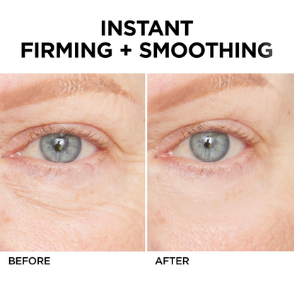 ⏰Last Day Sale 50% OFF🔥Instant Wrinkle Eye Tightener cream✅
