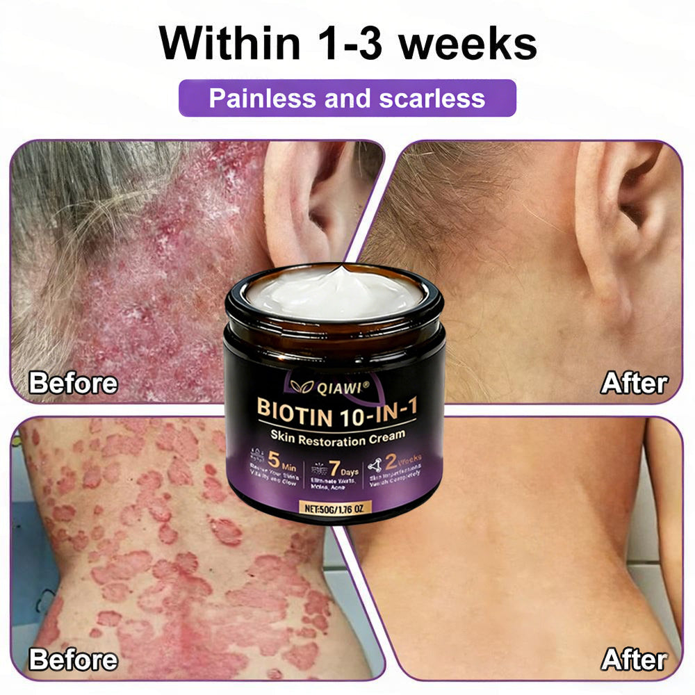 Made and Shipped from USA🍁QIAWI® Biotin 10-in-1 Skin Restoration Cream - Last Day Promotion: 75% OFF