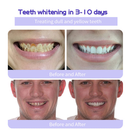 🎁Flash Sale - Don’t Miss Out - BBOJI™ TeethRestoration Mineral Powder🦷(TGA recommended)👩‍⚕️(Treats periodontitis and mouth ulcers, prevents tooth loss, and repairs gum recession)