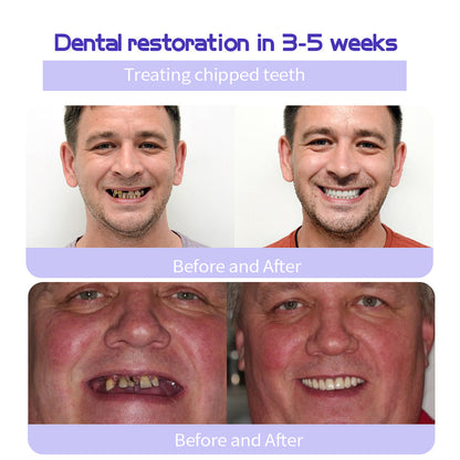 🎁Flash Sale - Don’t Miss Out - BBOJI™ TeethRestoration Mineral Powder🦷(TGA recommended)👩‍⚕️(Treats periodontitis and mouth ulcers, prevents tooth loss, and repairs gum recession)
