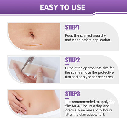 ✅Official Store |BBOJI® Hyaluronic Acid Nano Microneedle Repair Tape🏥(Treatment of old and new scars, reduction of surgical scars, stretch marks, keloids, acne, burns, warts, dermatomes and varicose veins)