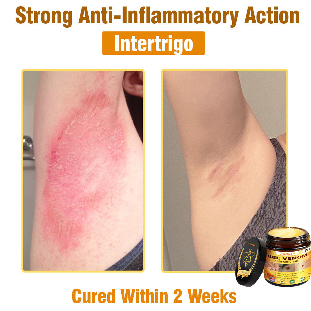 ClearBee™ Bee Venom All-in-One Cream US Dermatologist Approved🍃