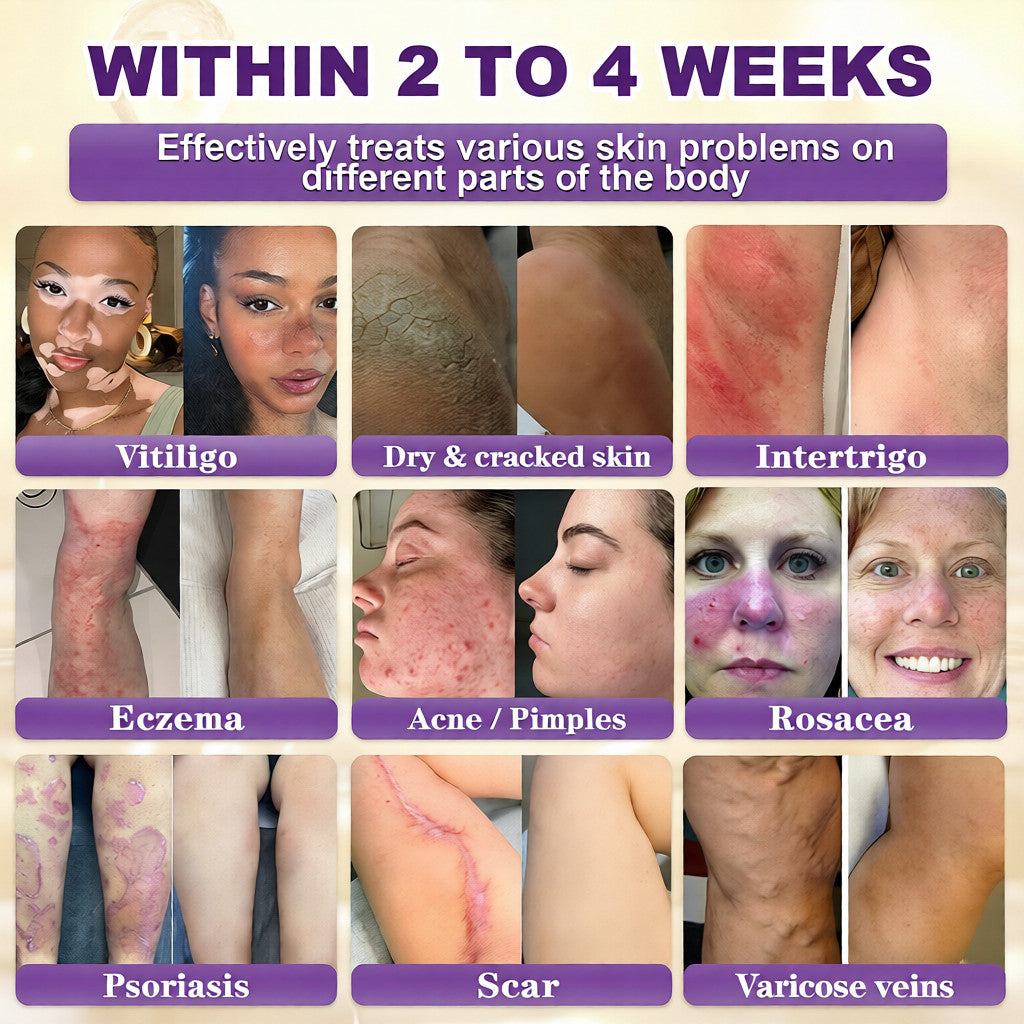 Made and Shipped from USA🍁QIAWI® Biotin 10-in-1 Skin Restoration Cream - Last Day Promotion: 75% OFF