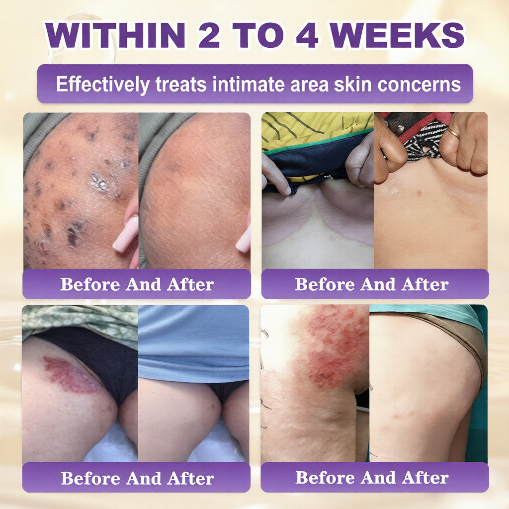 Made and Shipped from USA🍁QIAWI® Biotin 10-in-1 Skin Restoration Cream - Last Day Promotion: 75% OFF