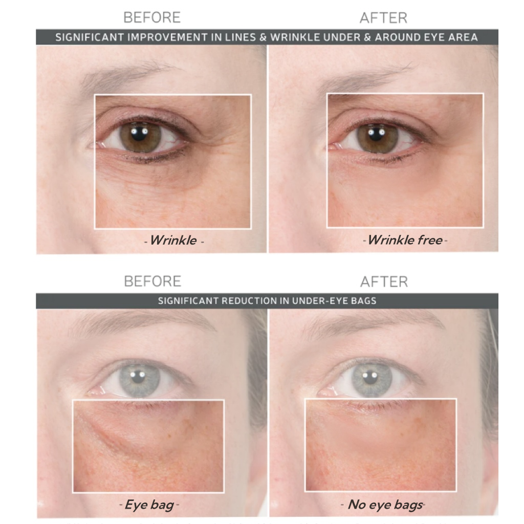 ⏰Last Day Sale 50% OFF🔥Instant Wrinkle Eye Tightener cream✅