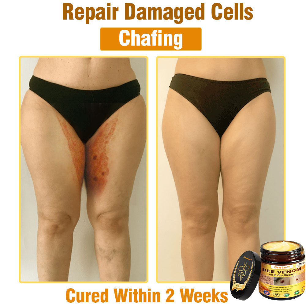 ClearBee™ Bee Venom All-in-One Cream US Dermatologist Approved🍃