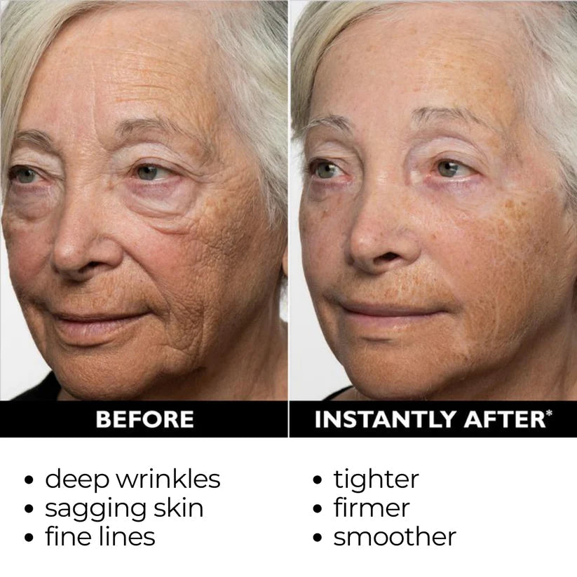 ⏰Last Day Sale 50% OFF🔥Instant Wrinkle Eye Tightener cream✅