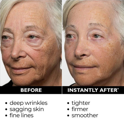 ⏰Last Day Sale 50% OFF🔥Instant Wrinkle Eye Tightener cream✅