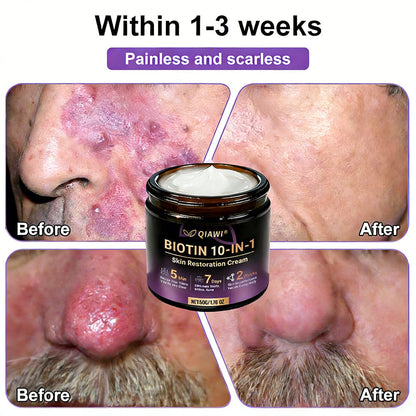Made and Shipped from USA🍁QIAWI® Biotin 10-in-1 Skin Restoration Cream - Last Day Promotion: 75% OFF