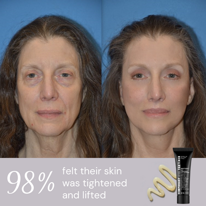 ⏰Last Day Sale 50% OFF🔥Instant Wrinkle Eye Tightener cream✅