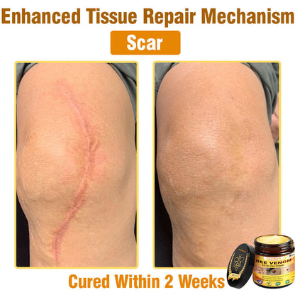 ClearBee™ Bee Venom All-in-One Cream US Dermatologist Approved🍃