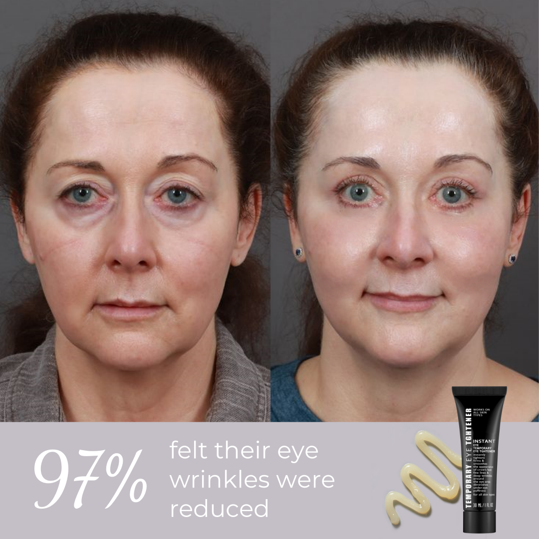 ⏰Last Day Sale 50% OFF🔥Instant Wrinkle Eye Tightener cream✅